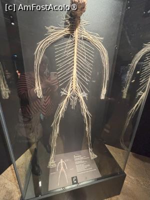 [P10] BODY WORLDS (expozitie de corpuri si organe plastinate) - sistemul nervos » foto by mishu
 - 
<span class="allrVoted glyphicon glyphicon-heart hidden" id="av1472930"></span>
<a class="m-l-10 hidden" id="sv1472930" onclick="voting_Foto_DelVot(,1472930,4083)" role="button">șterge vot <span class="glyphicon glyphicon-remove"></span></a>
<a id="v91472930" class=" c-red"  onclick="voting_Foto_SetVot(1472930)" role="button"><span class="glyphicon glyphicon-heart-empty"></span> <b>LIKE</b> = Votează poza</a> <img class="hidden"  id="f1472930W9" src="/imagini/loader.gif" border="0" /><span class="AjErrMes hidden" id="e1472930ErM"></span>