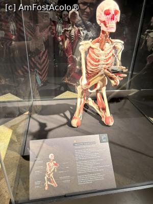 [P08] BODY WORLDS (expozitie de corpuri si organe plastinate) - deci este un corp adevarat, platinat » foto by mishu
 - 
<span class="allrVoted glyphicon glyphicon-heart hidden" id="av1472928"></span>
<a class="m-l-10 hidden" id="sv1472928" onclick="voting_Foto_DelVot(,1472928,4083)" role="button">șterge vot <span class="glyphicon glyphicon-remove"></span></a>
<a id="v91472928" class=" c-red"  onclick="voting_Foto_SetVot(1472928)" role="button"><span class="glyphicon glyphicon-heart-empty"></span> <b>LIKE</b> = Votează poza</a> <img class="hidden"  id="f1472928W9" src="/imagini/loader.gif" border="0" /><span class="AjErrMes hidden" id="e1472928ErM"></span>